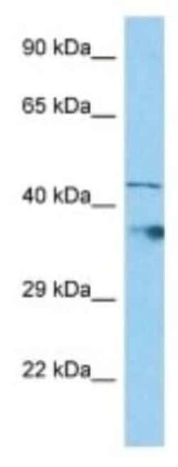 LDHAL6B Rabbit anti-Human, Polyclonal, Novus Biologicals 100 &mu;g; Unconjugated:Antibodies,
